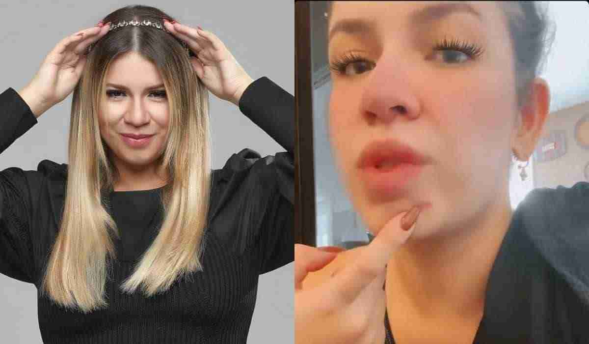 Marilia Mendonça desabafa sobre acnes após uso do DIU: 'não para'
