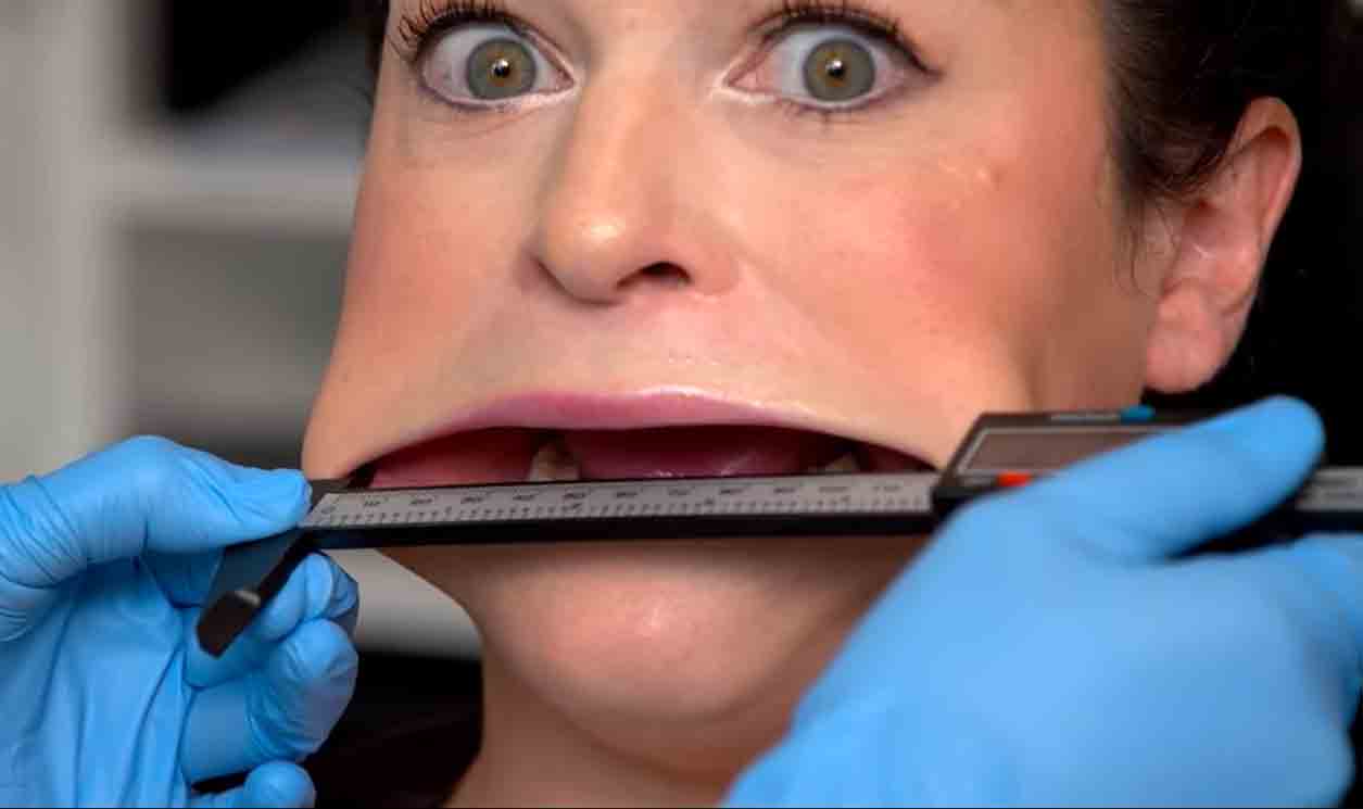 TikToker quebra o recorde de maior boca feminina do mundo. Foto: Reprodução Youtube