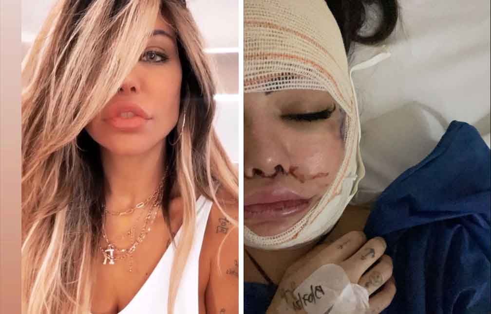 Após confusão com policiais em festa, Liziane Gutierrez faz procedimento no rosto. Foto: Reprodução Instagram