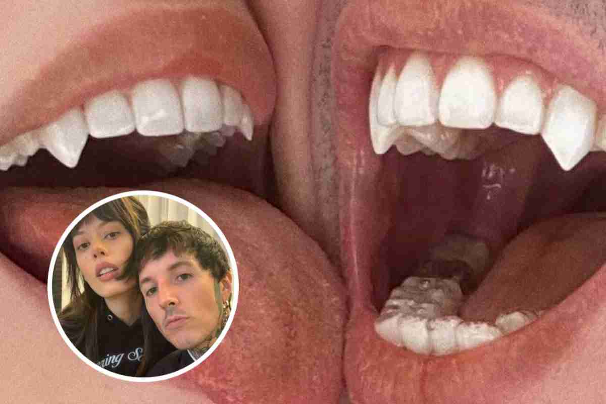 Oliver Sykes e esposa implantam presas de vampiro (Foto: Reprodução/Instagram)