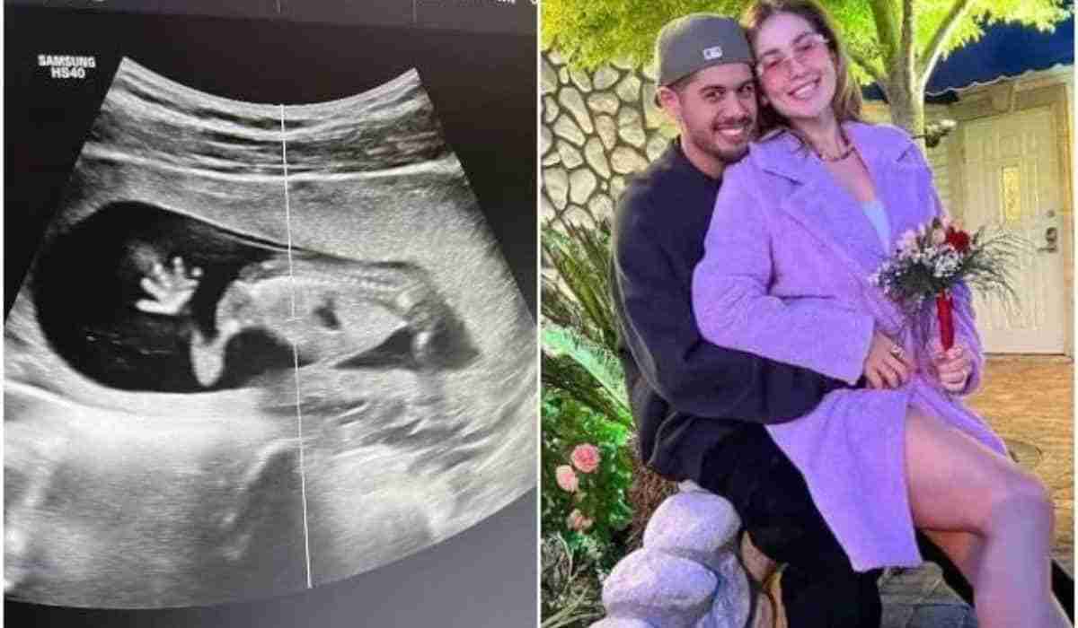 Virgínia exibe ultrassom de sua segunda gravidez: ‘já te amo muito’ (Foto: Reprodução/Instagram)