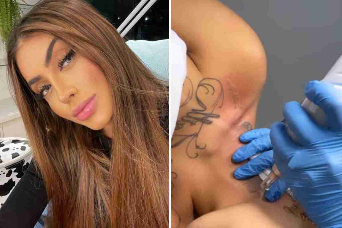 Mirella remove tatuagem com rosto do ex-marido, Dynho Alves (Foto: Reprodução/Instagram)