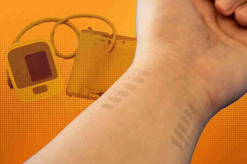 Tatuagem de grafeno pode monitorar a pressão sanguínea; saiba mais