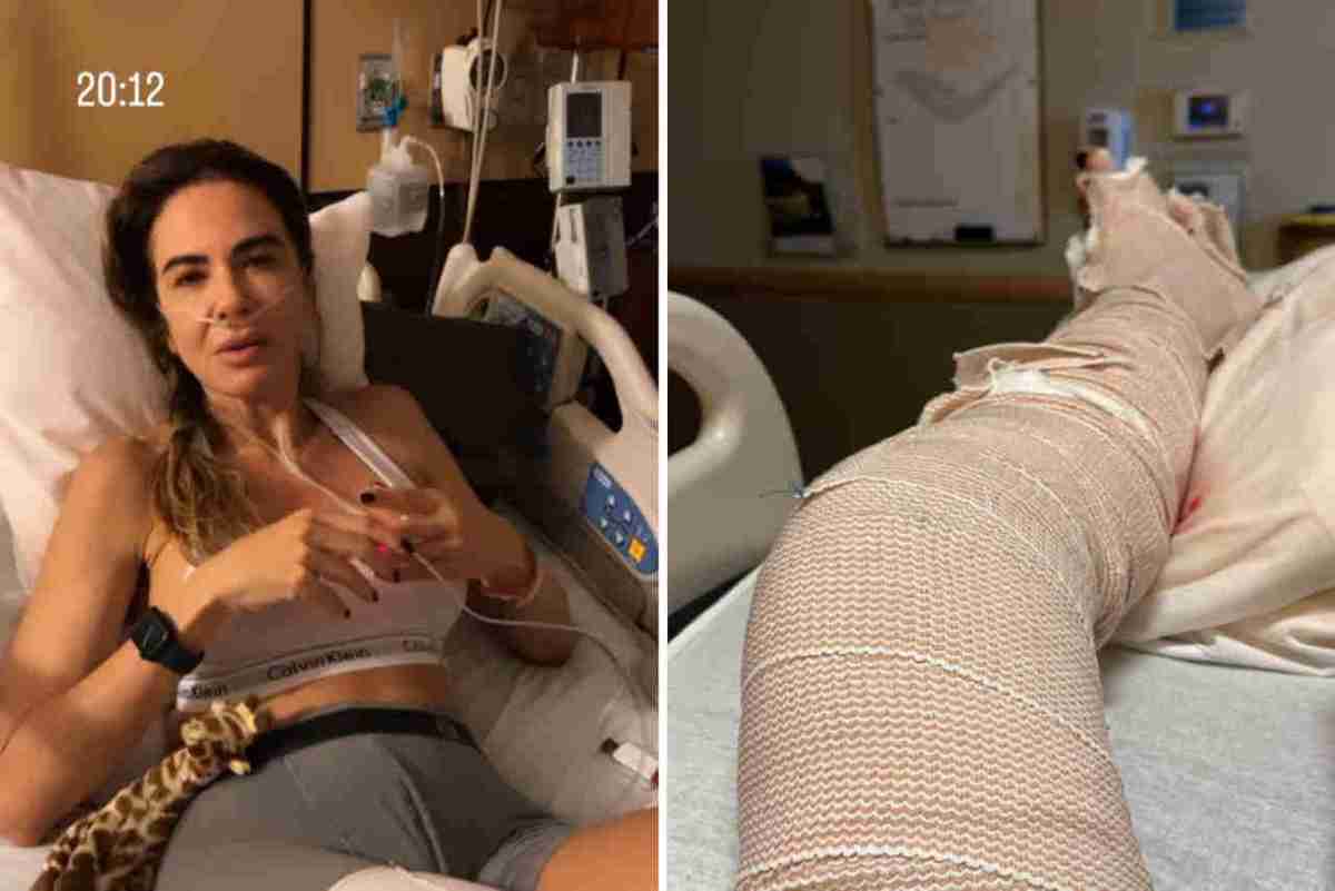 Luciana Gimenez atualiza fãs após quebrar a perna em acidente: “Muita dor” (Foto: Reprodução/Instagram)