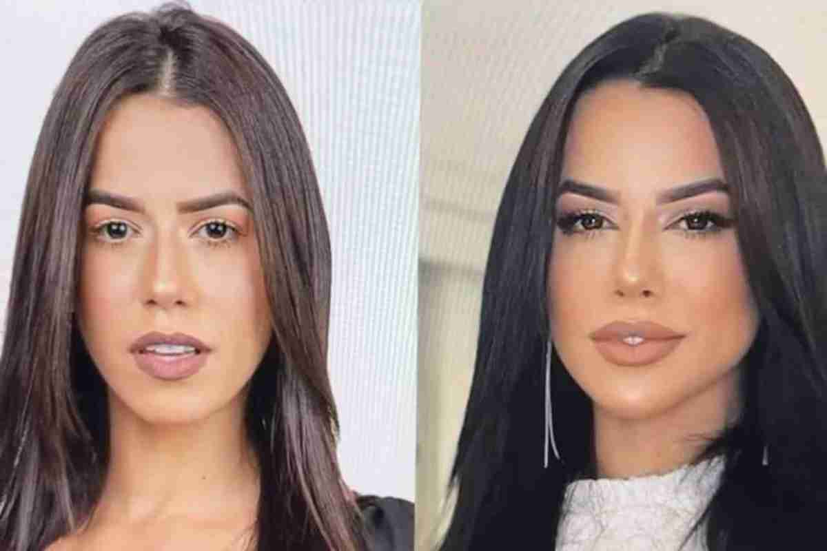 Ex-BBB Larissa Tomásia surpreende com antes e depois de harmonização facial (Foto: Reprodução/Twitter)