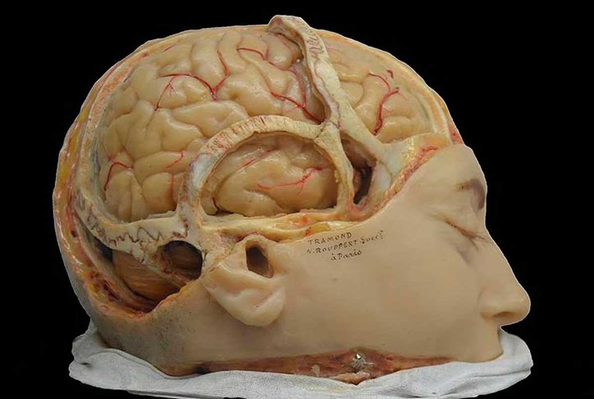 Modelo en cera de cerebro humano. Foto: Wikipedia