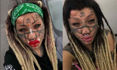 Italian woman undergoes over 20 plastic surgeries to look like a cat; check out the before and after